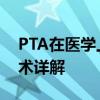 PTA在医学上是什么意思 经皮腔内血管成形术详解